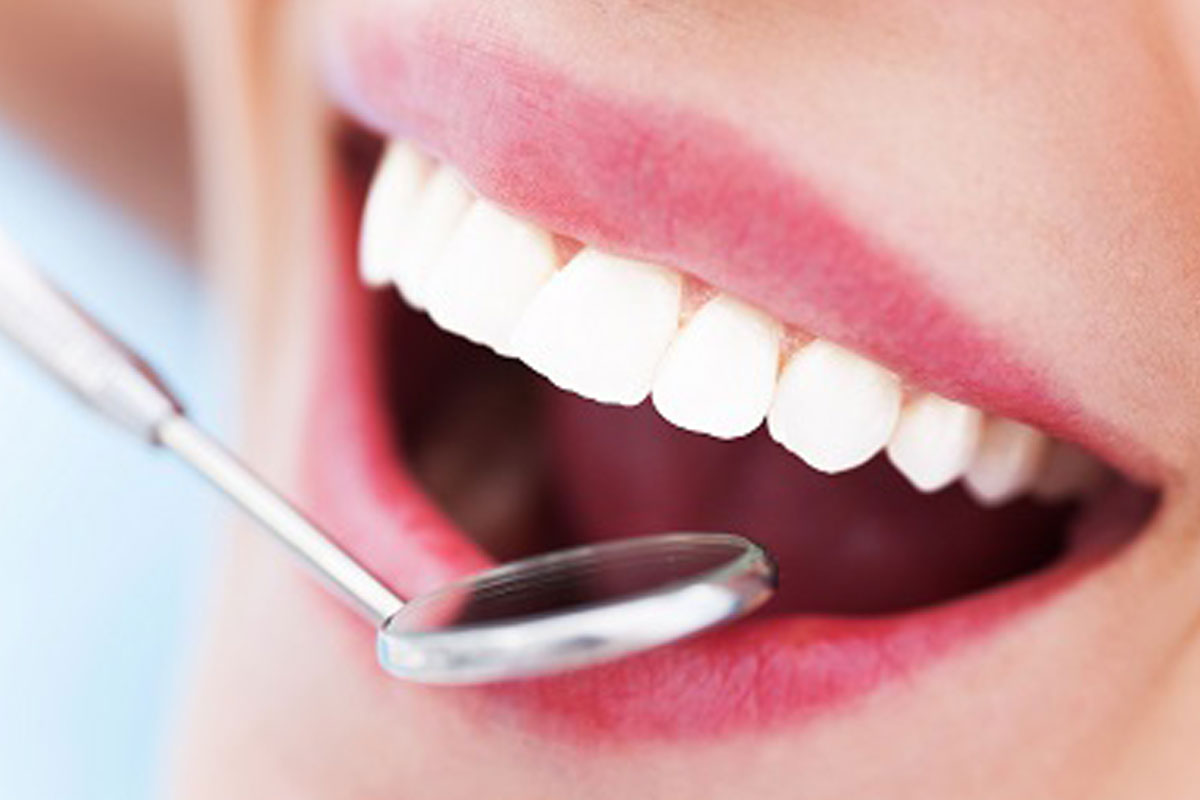 השתלות שיניים – כל מה שאתם צריכים לדעת